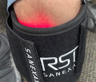 chris's synRG knee.edit