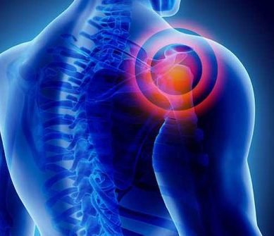 frozen-shoulder-s1-what-is-it